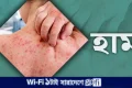 ফরিদপুরে হাম উপসর্গে আরও ২ শিশুর মৃত্যু | | বাংলাদেশ প্রতিদিন